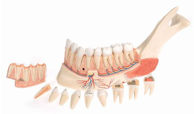 Pokročilá polovičná dolná čeľusť s 8 chorými zubami, 19 častí
