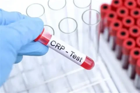 CRP hodnoty: Kedy je dôvod na obavy