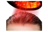 Laserová helma na podporu rastu vlasov