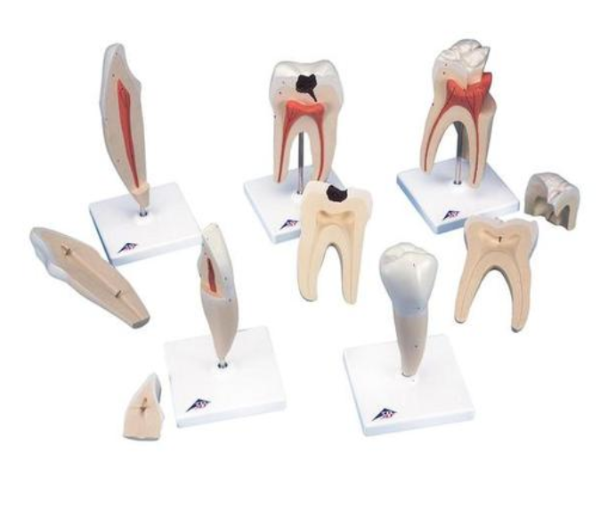 Klasický model zubov, 5 modelov