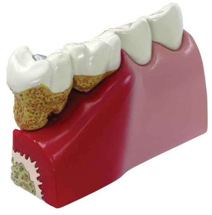 Model zubov