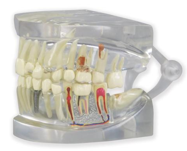 Jasný model ľudskej čeľuste so zubami