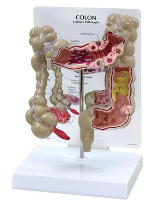 Model hrubého čreva