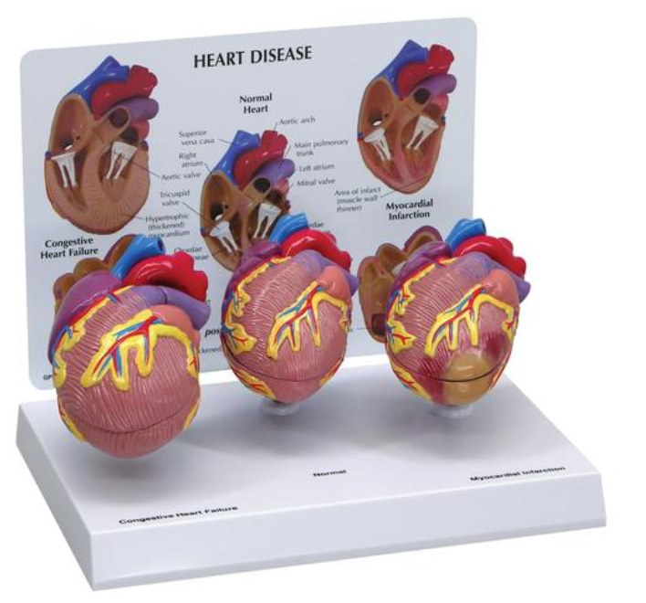 Súprava modelov 3-mini srdcia