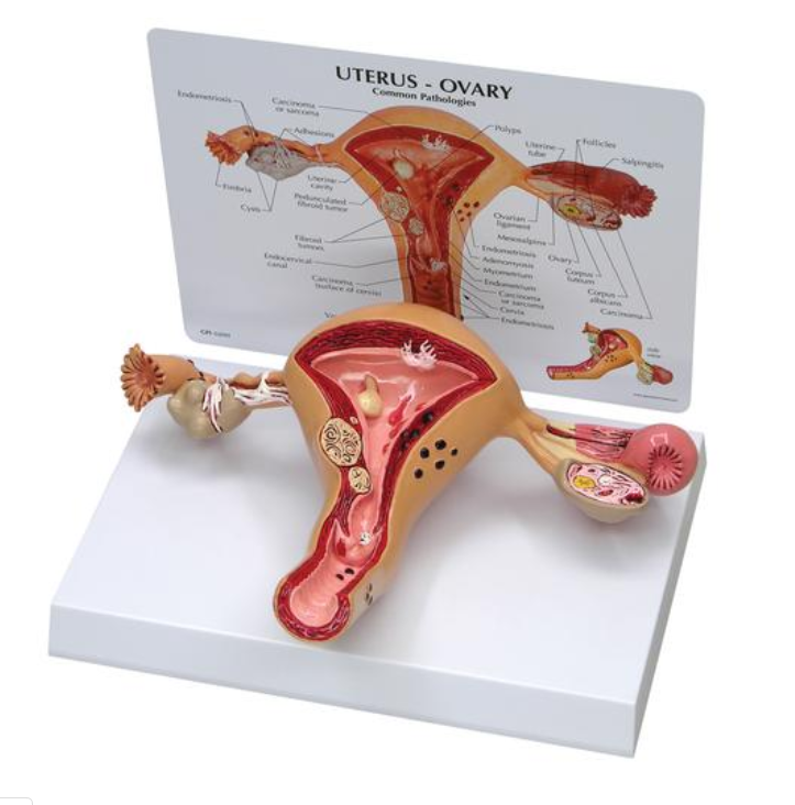 Model maternice a vaječníkov