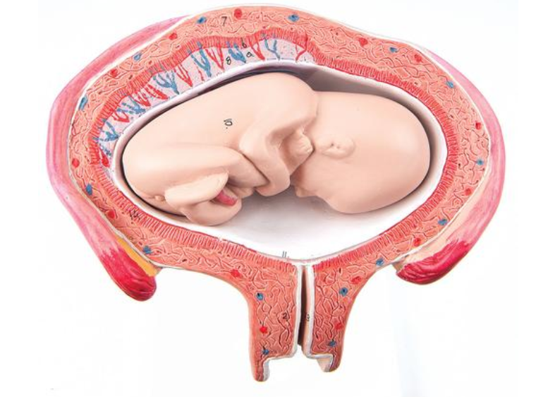 Model plodu, 4 mesiac, abdominálna poloha