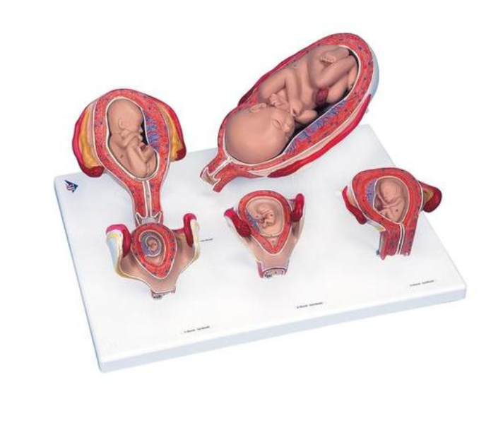 Séria tehotenstva, 5 modelov