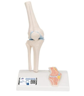 Mini model ľudského kolenného kĺbu s prierezom