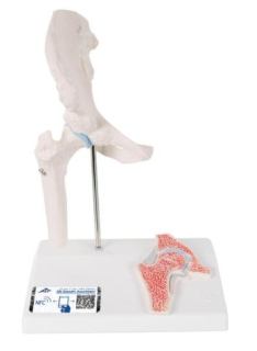 Mini model ľudského bedrového kĺbu s prierezom
