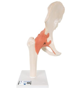 Model bedrového kĺbu s väzbami a označenou chrupavkou